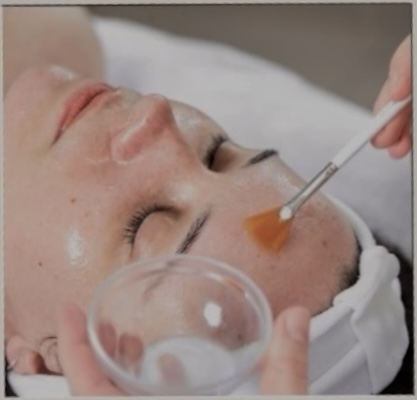 Chemical Peel Facial