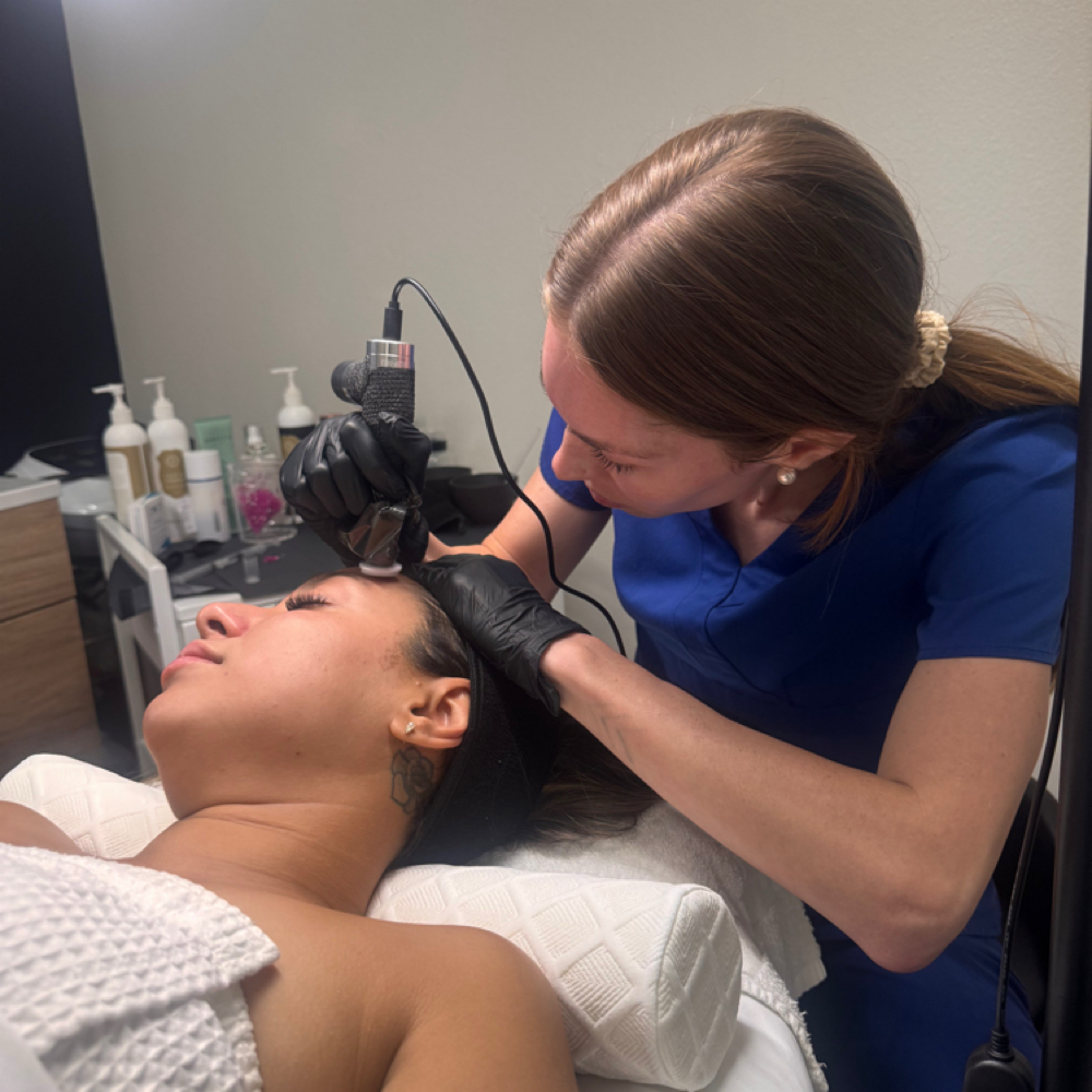 Microchanneling Face Neck Hands at The Nice Needle and Spa in Prosper, TX