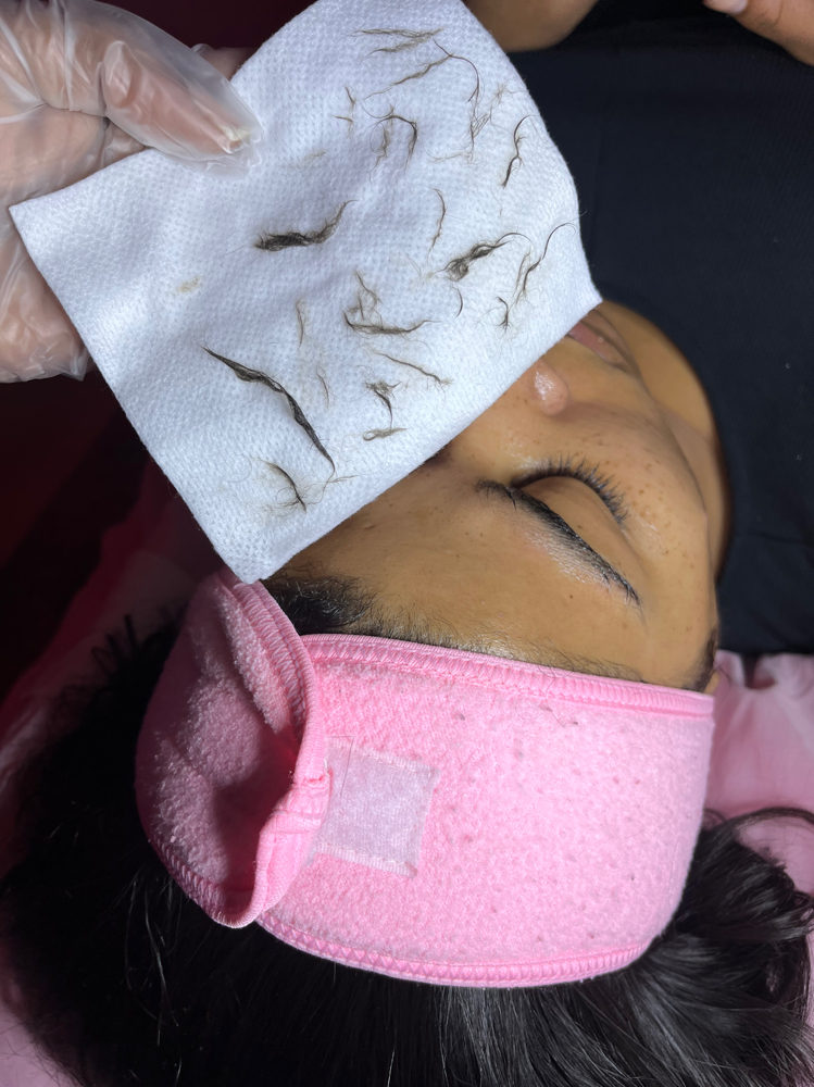 ✨DermaTrap Facial✨