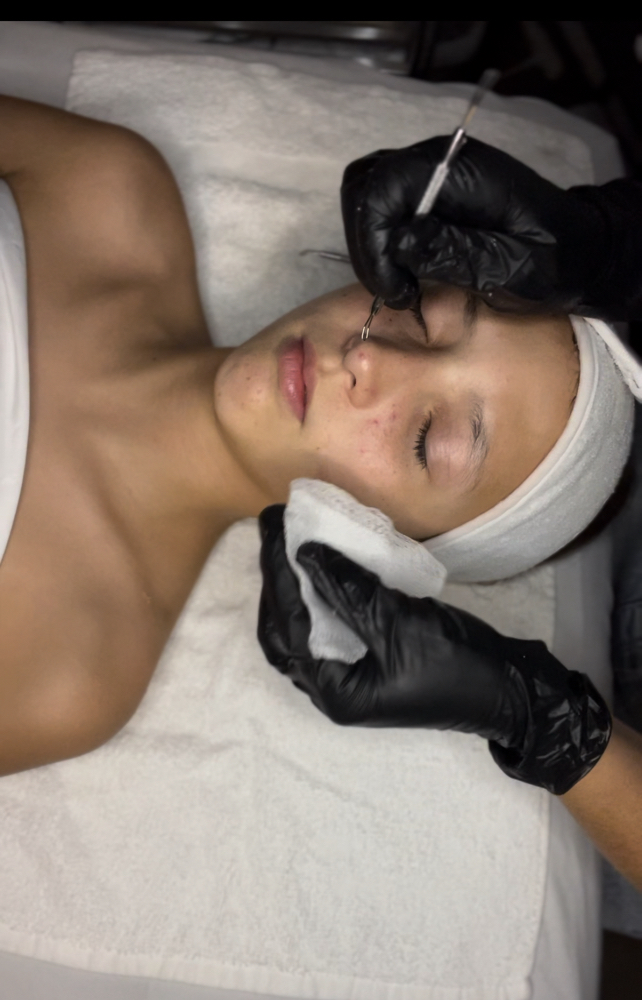 Teen Facial