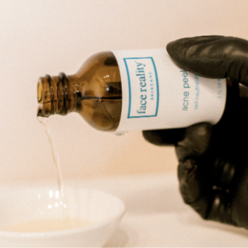 Face Reality Acne Peel at Skin & Soul in Brooklyn, NY
