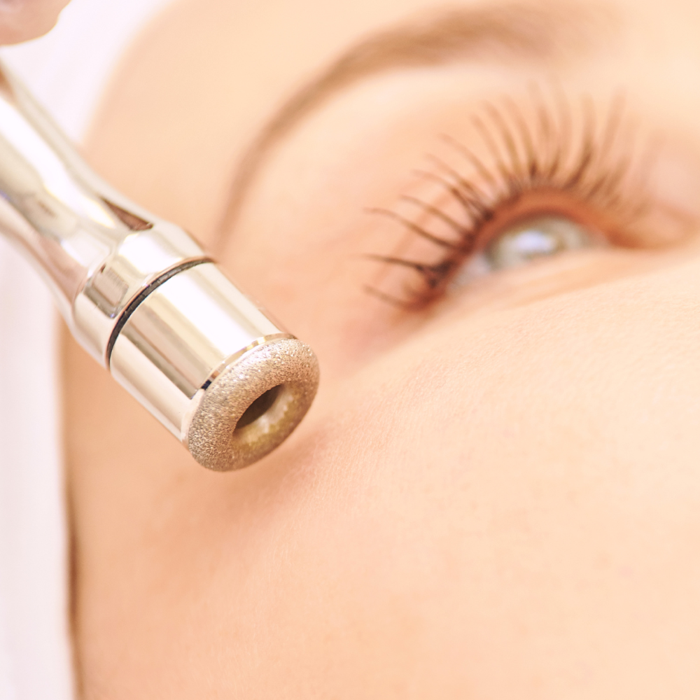 Microdermabrasion  Facial