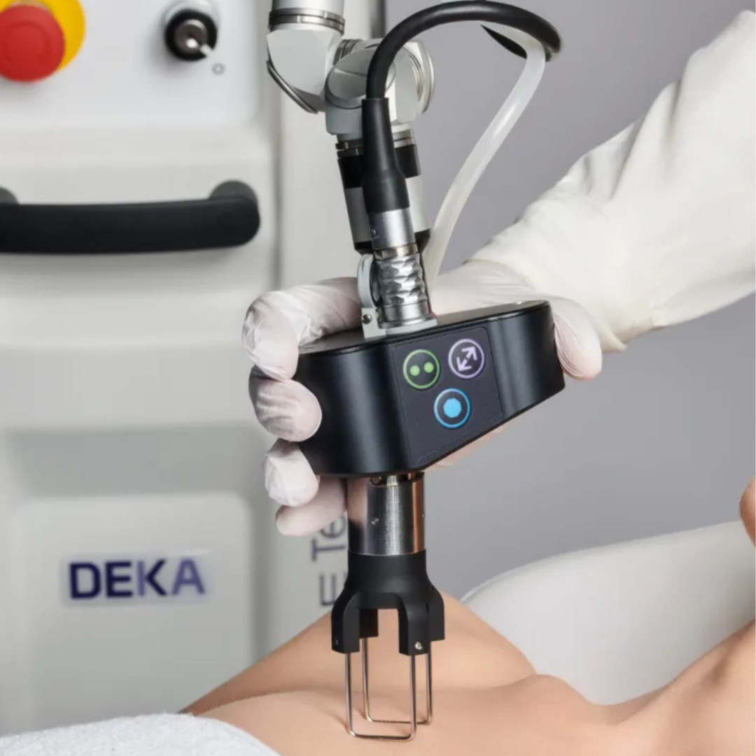 Deka CO2 Laser at Luna Aesthetics in Alexandria, VA