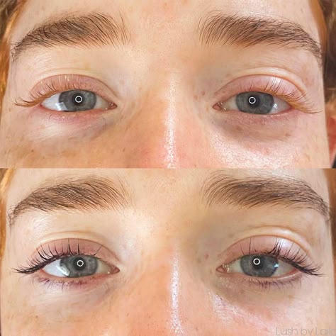Lash Enhancement