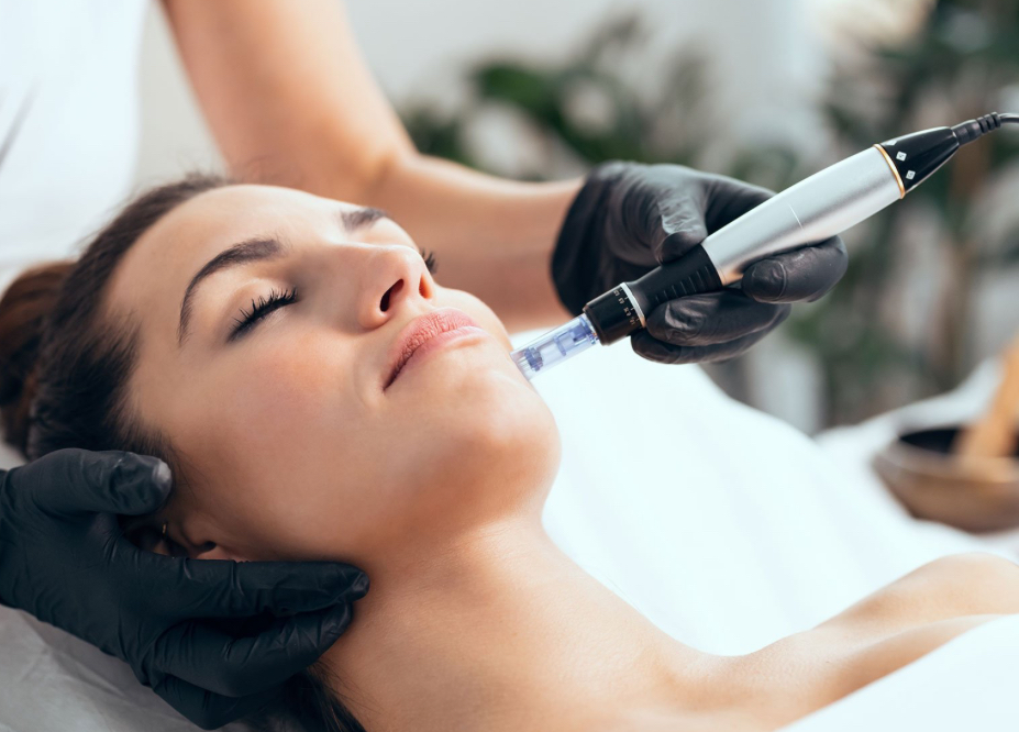 Microneedling 3 Pack