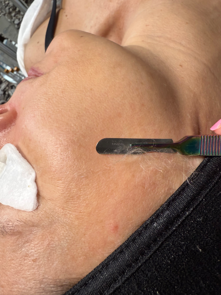 Dermaplaning Facial