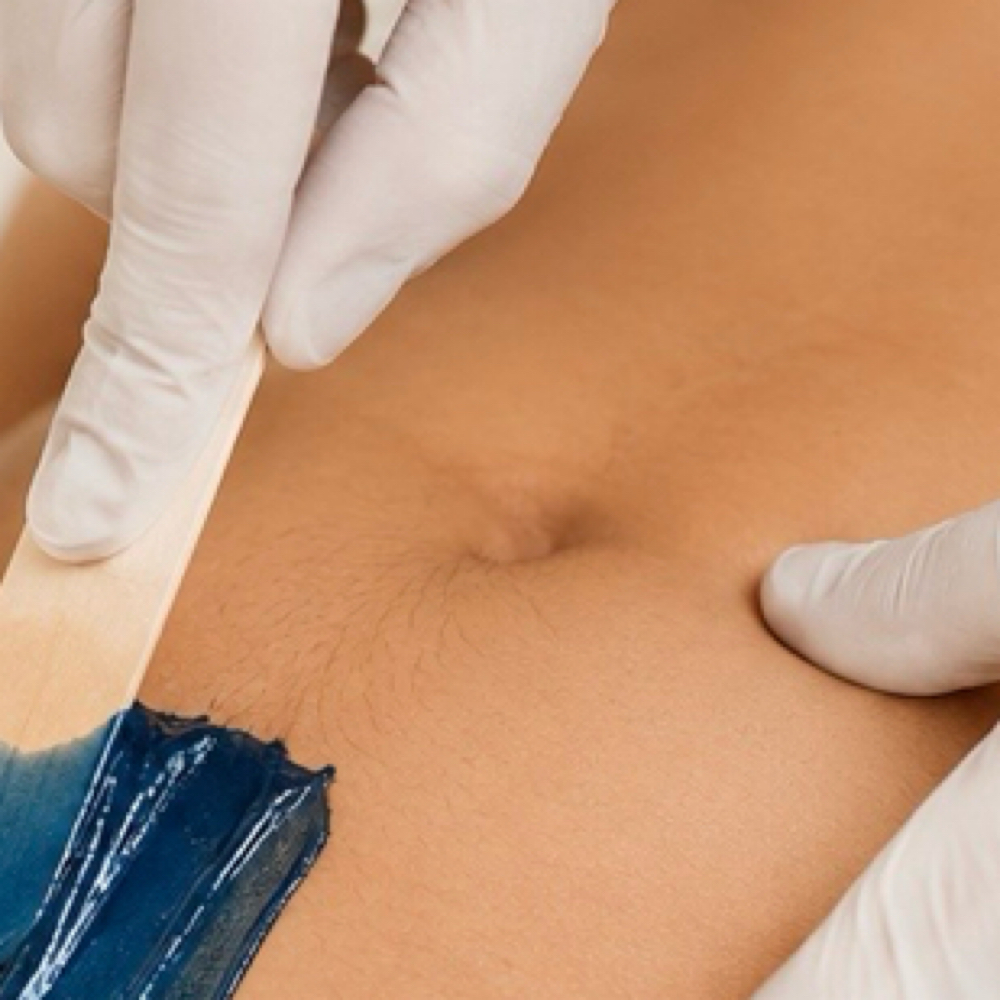 Bikini Full at Nirvana MedSpa PLLC in Charlotte, NC