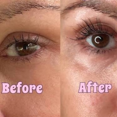LATISSE EYELASH GROWTH SERUM - 5ML at LEXTHETICS | Powered by Smiley Aesthetics & Dr. Katrina Briggs, MD in Columbus, OH
