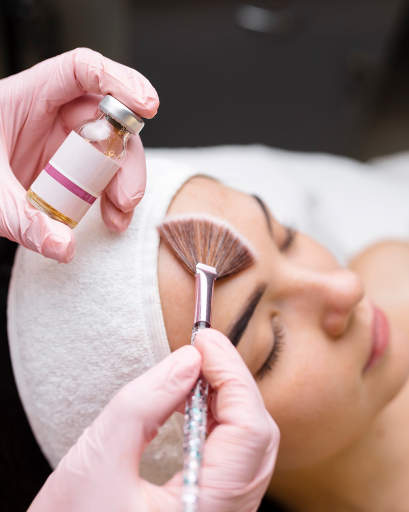 Chemical Peel at M.A.V Aesthetics in Fort Morgan, CO