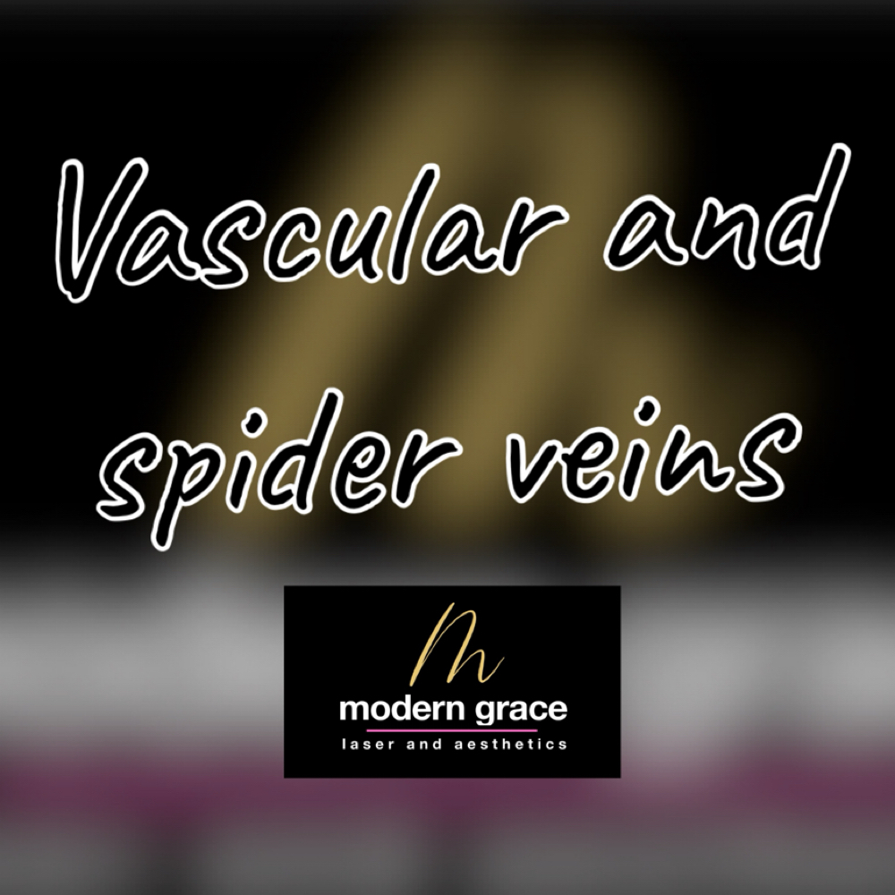 Vascular / Spider Veins at Modern Grace Laser and Aesthetics in San Tan Valley, AZ