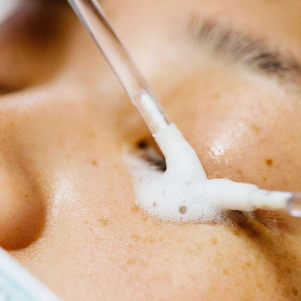 Lash Removal at Lash & Relax in Stephenville, TX