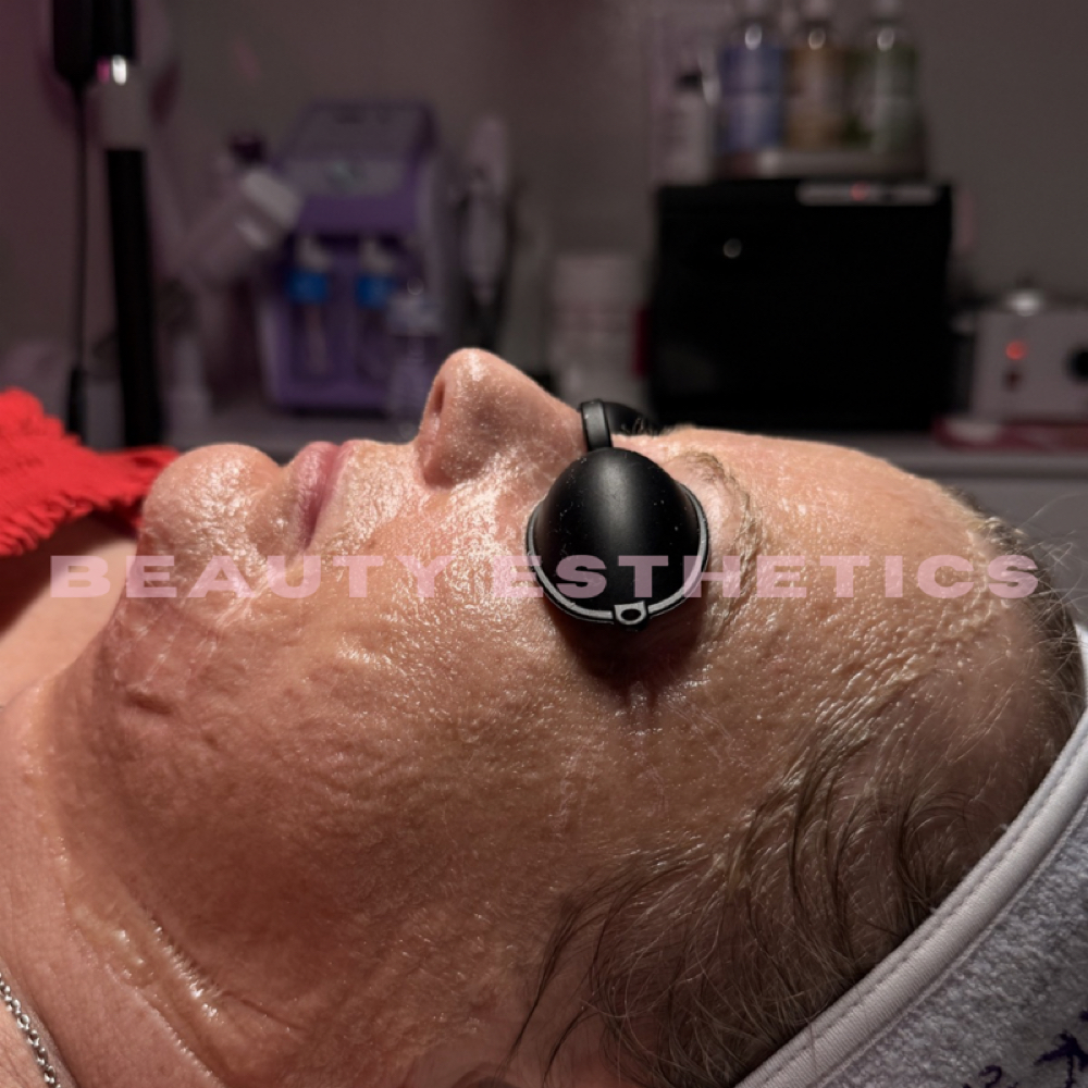 Luxe Lift Facial at Beauty Esthetics in De Queen, AR