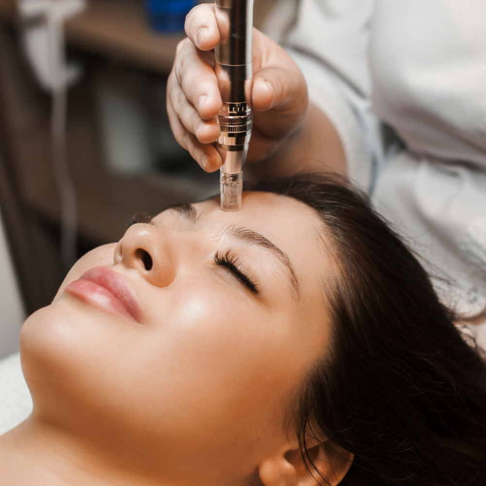 Nanoinfusion at Lux Aesthetics in Rockford, IL