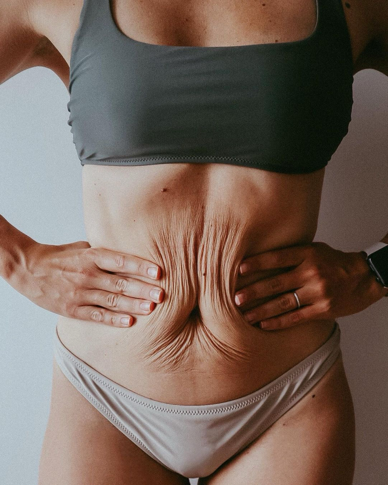 The Firmed Body