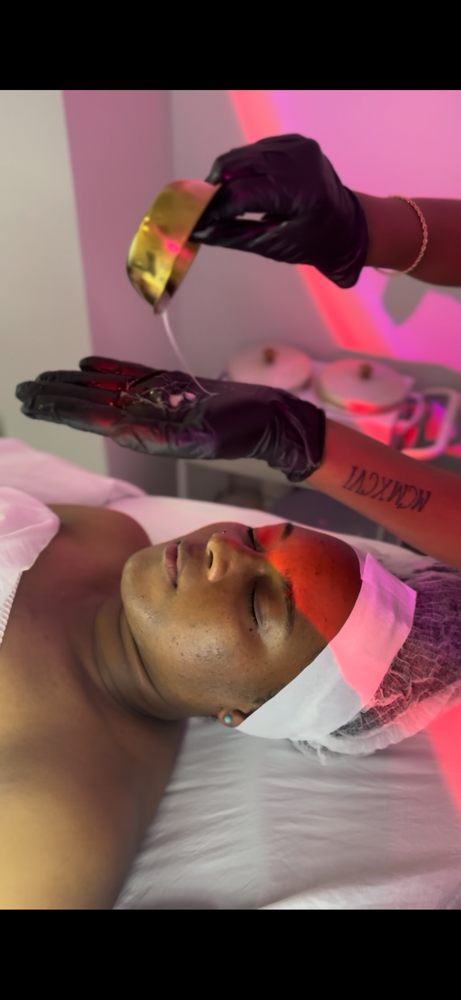 Acne Recovery Facial