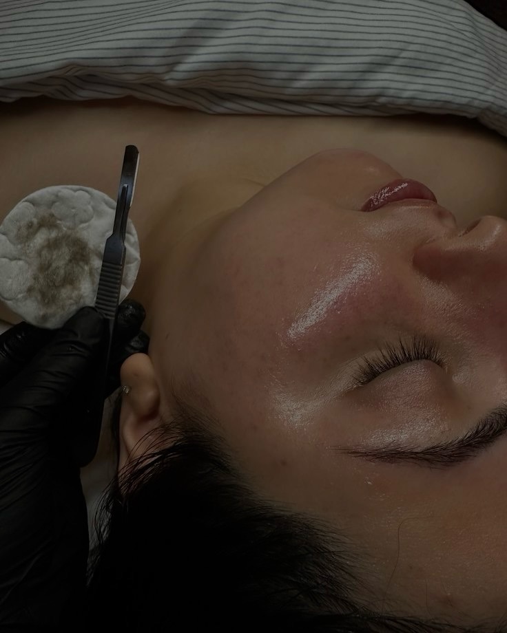 Bye-Bye Peach Fuzz Facial