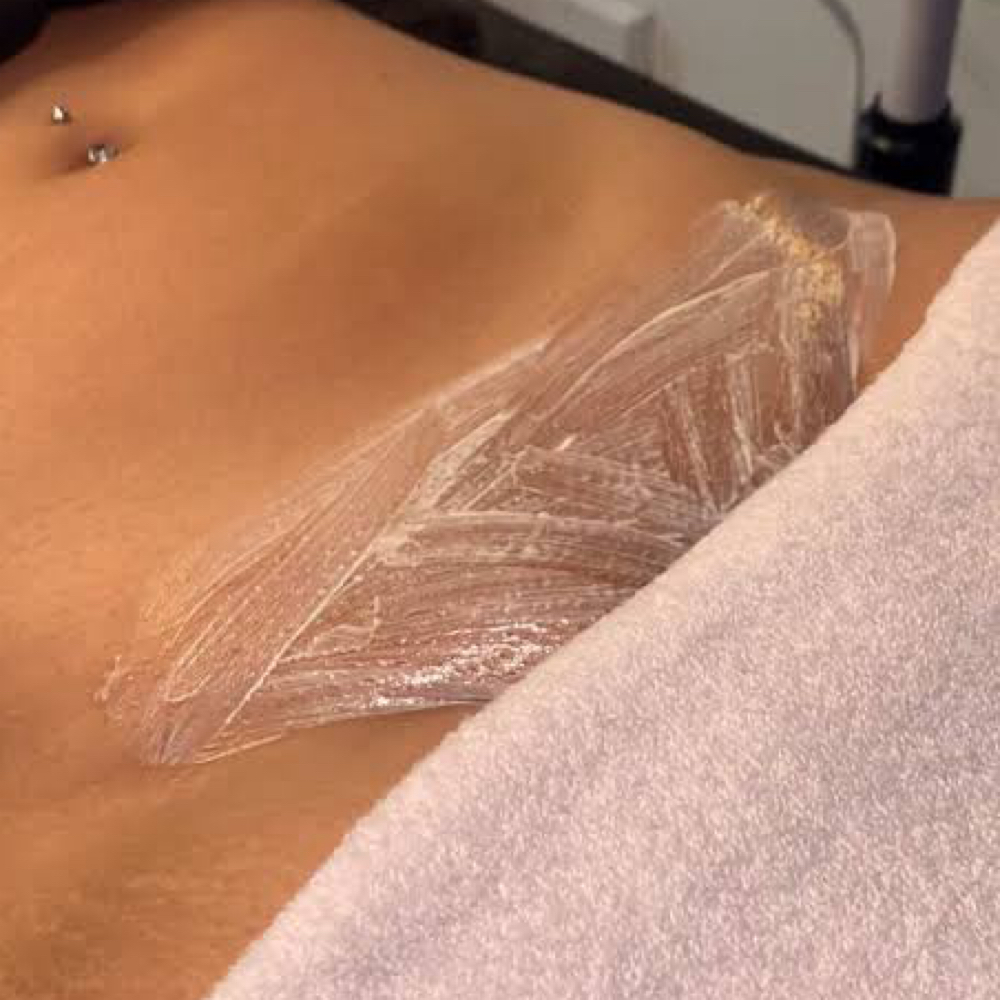 VAJACIAL at arbesthetics in dorcester, MA