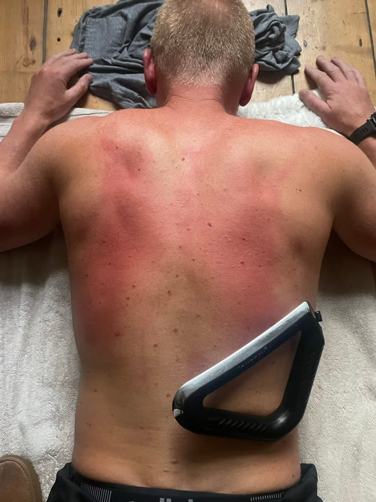 Muscle Scraping- ADD ON