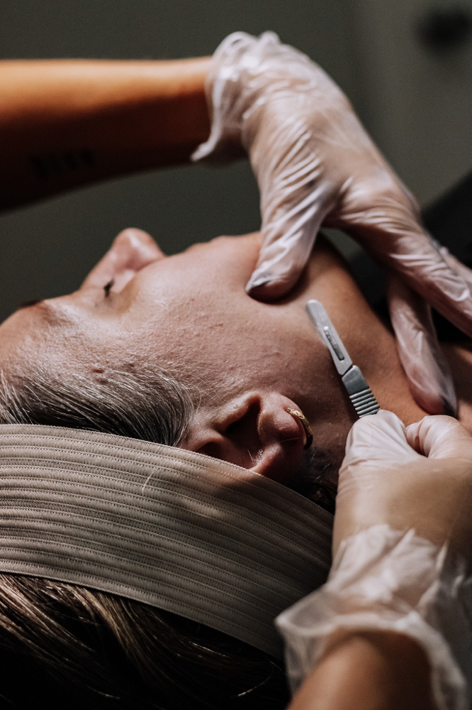 Dermaplaning