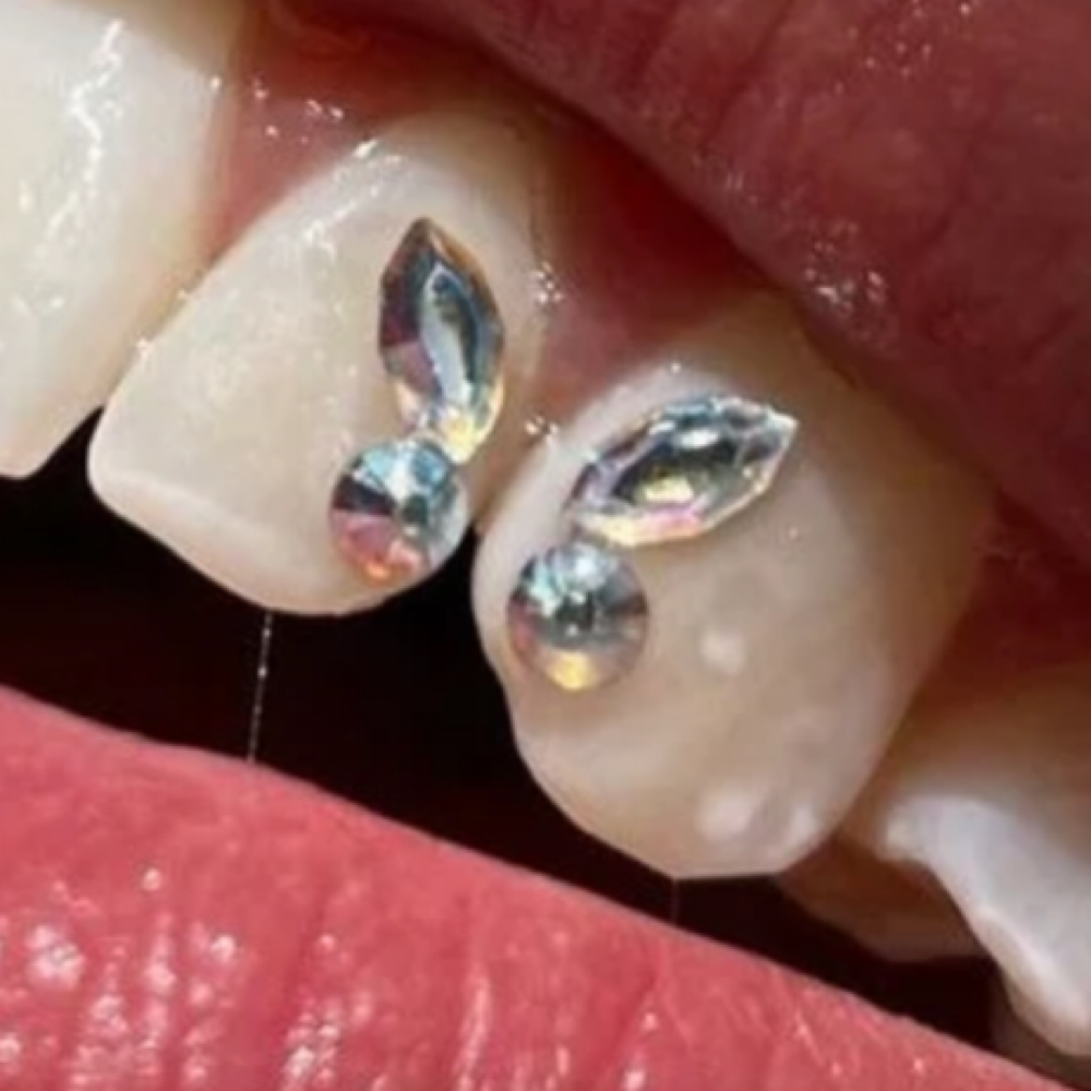 Single Tooth Gem at Zoey Spa LLC in Chandler, AZ