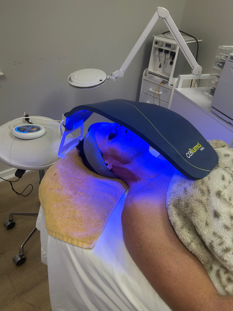 + Add On Celluma Red Light Therapy