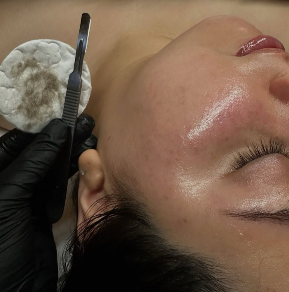 Glass Skin Glow at Glowology Esthetics, LLC in Madison, AL