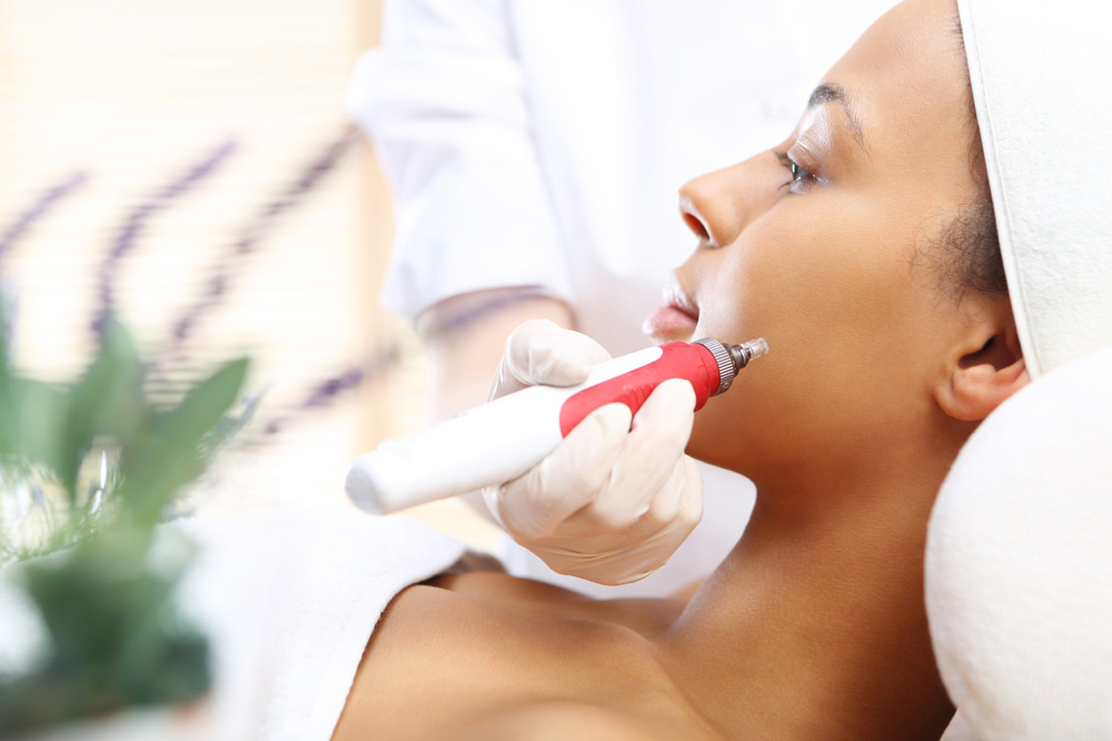 Microdermabrasion Facial
