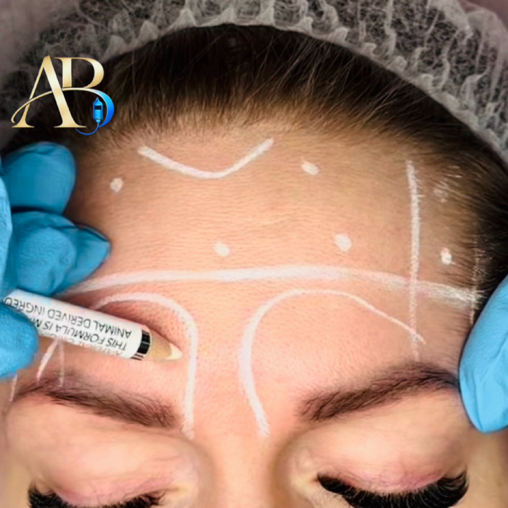 Neurotoxin Assesment at AB Wellness & IV Drip BAR in Henderson, NV