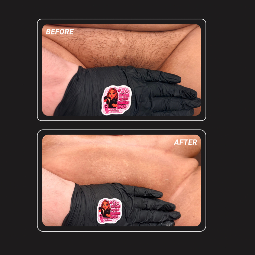 Intimate Waxing at MP Esthetics: Waxing & Skincare Murrieta in Murrieta, CA