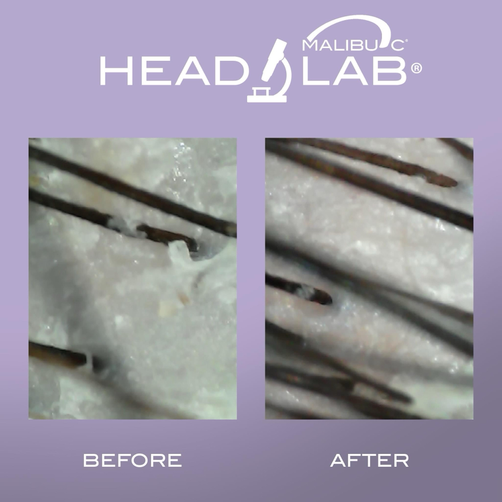 HEAD LAB SCALP ANALYSIS & TREATMENT