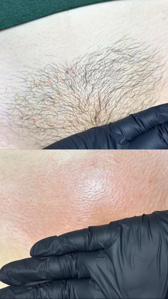 BRAZILIAN WAX
