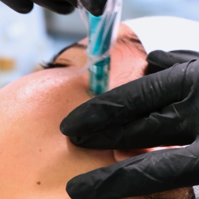 PACKAGE- Holistic Microneedling at Vegan Luxe Esthetics in Houston, TX