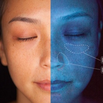 Personalized skin consultation at Corrective treatments + professional skincare in Atlanta, GA