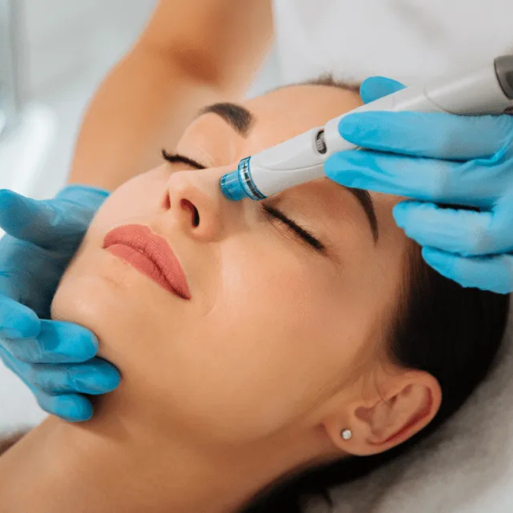 HydroDerm Facial at Radiance Aesthetics and Day Spa in Amarillo, TX