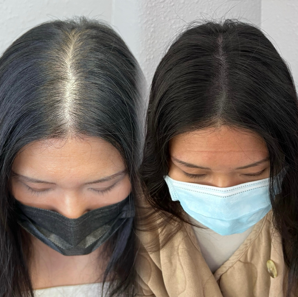 Scalp Micropigmentation Consultation at The Bar Aesthetics in Pinole, CA