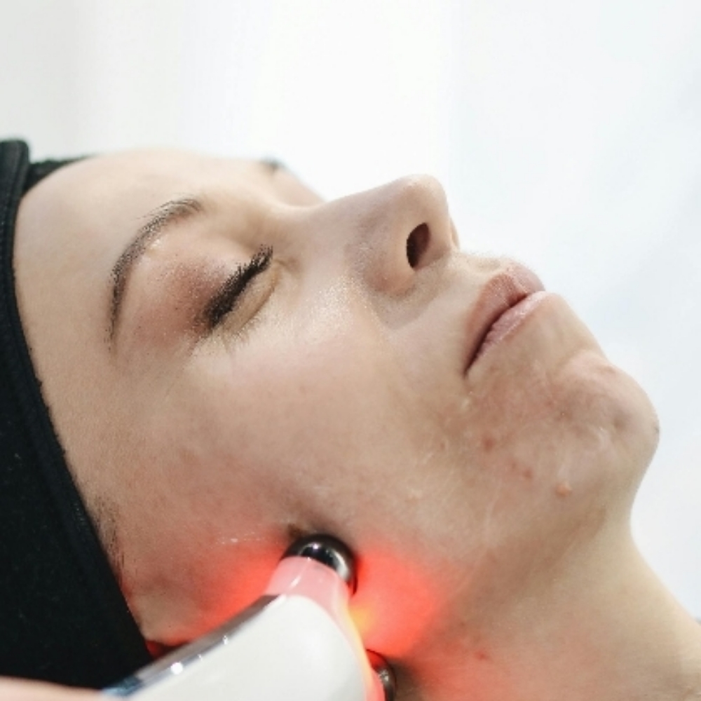 Renew+Clear · Hormonal & Adult Acne at The UnSpa | Skin Renewal Studio in Chandler, AZ