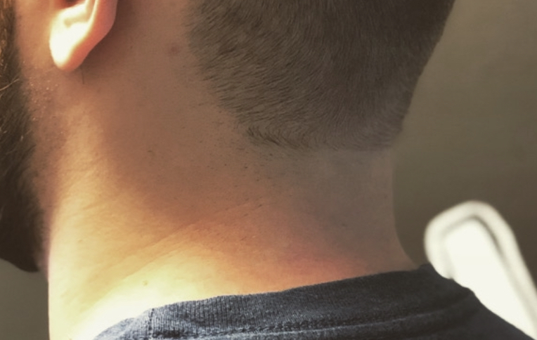 Neck Hair Trim