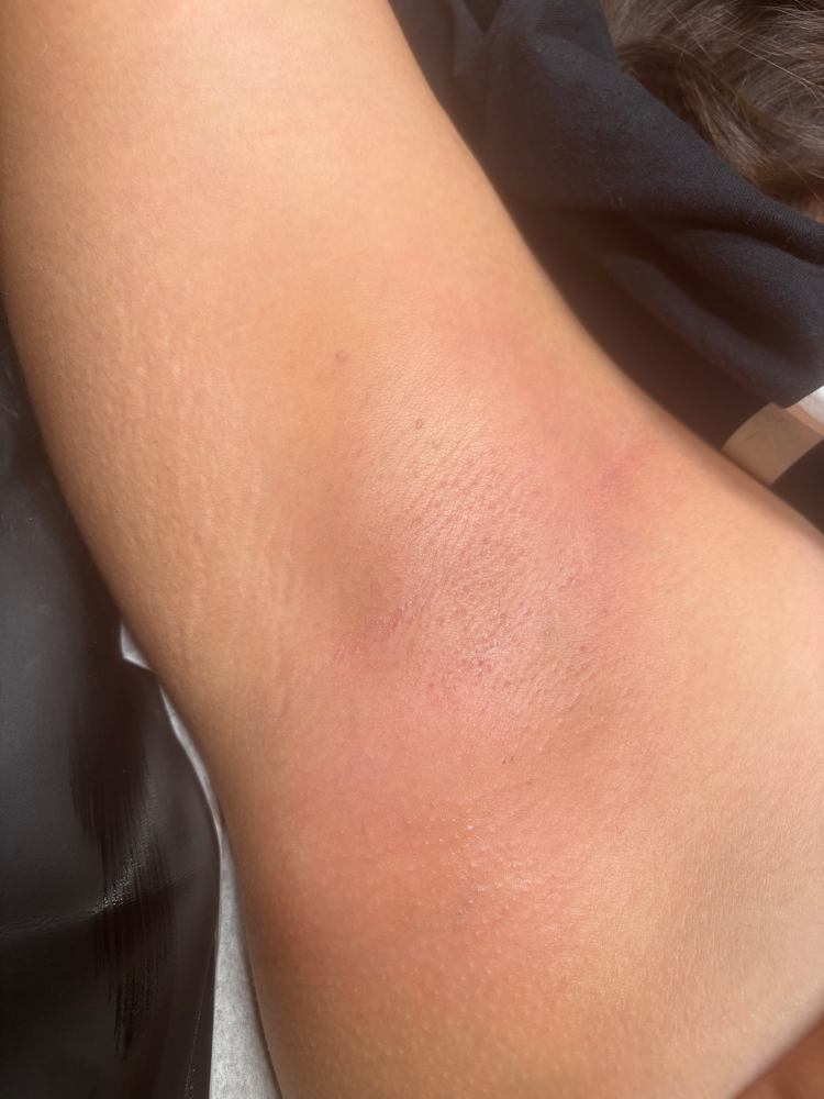 Underarms (Wax) at Soleil Beauty Bar LLC in Hartford, CT