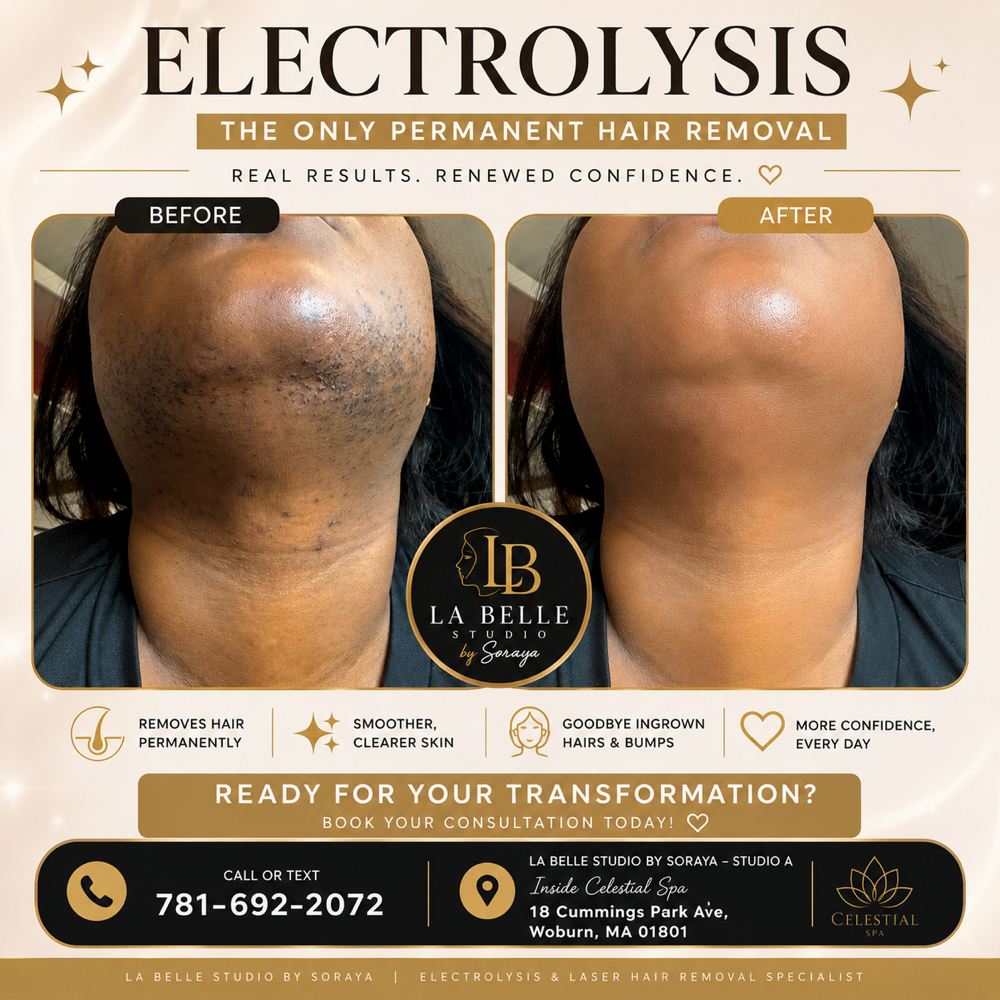 Electrolysis 30min at La Belle Studio by Soraya in Woburn, MA
