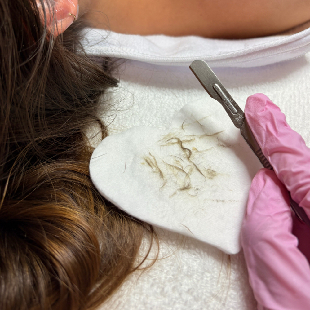 Tier 2: Advanced Custom Facial at Naturally Esthetics in Myrtle Beach, SC