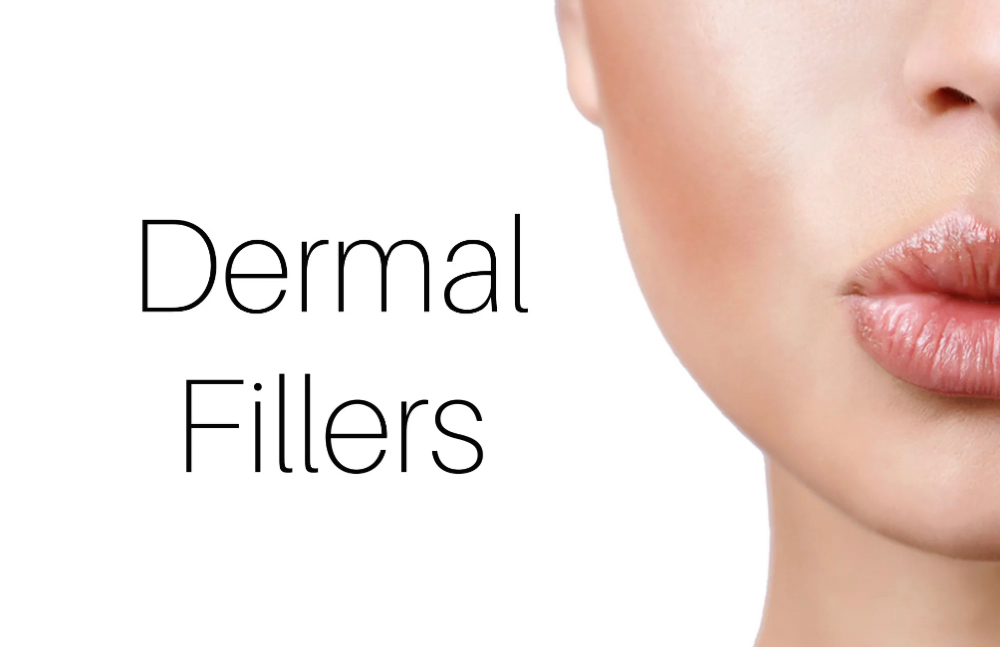 Dermal filler