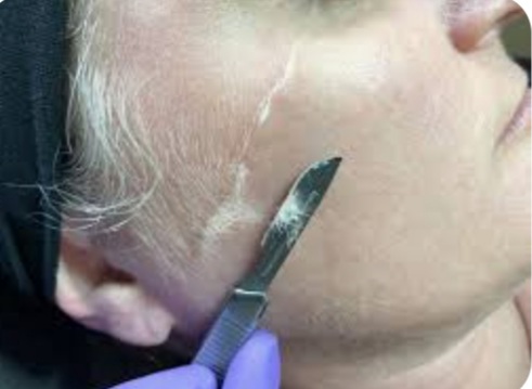 Dermaplane + (Includes Enzyme Peel)