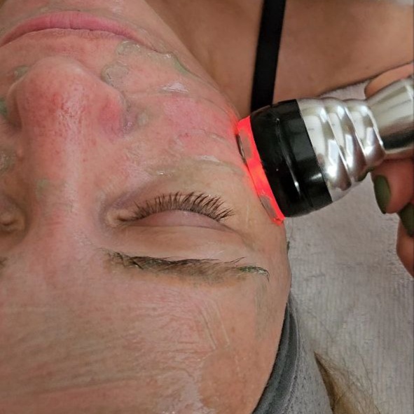 Microcurrent Treatment (EMS)