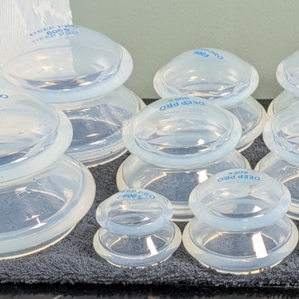 Cupping at Crafted Calm Massage LLC in Clementon, NJ