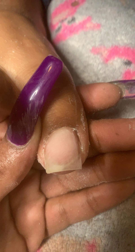 Nail Repair (Toes) at Itz Da NAILS 4 Me in Vicksburg, MS