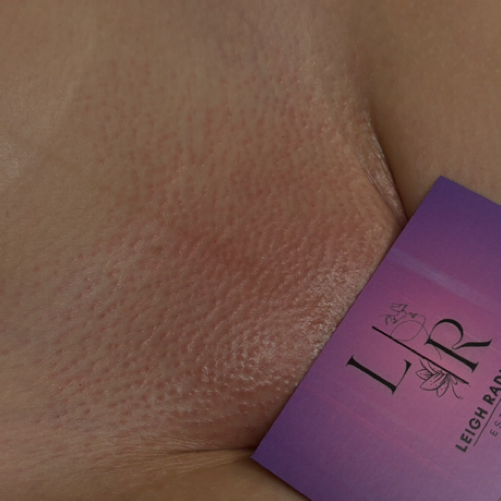 Brazilian Wax (First Time) at Leigh Radiance in Staunton, VA