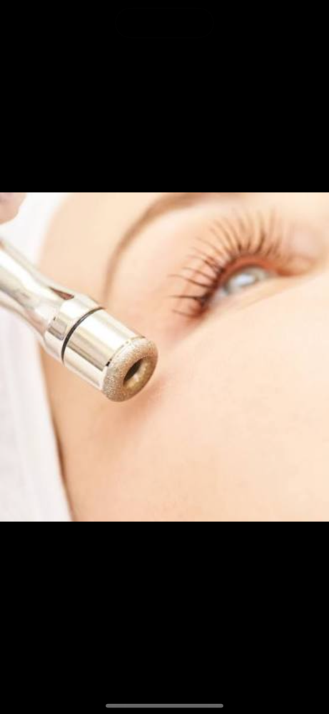Microdermabrasion Add On