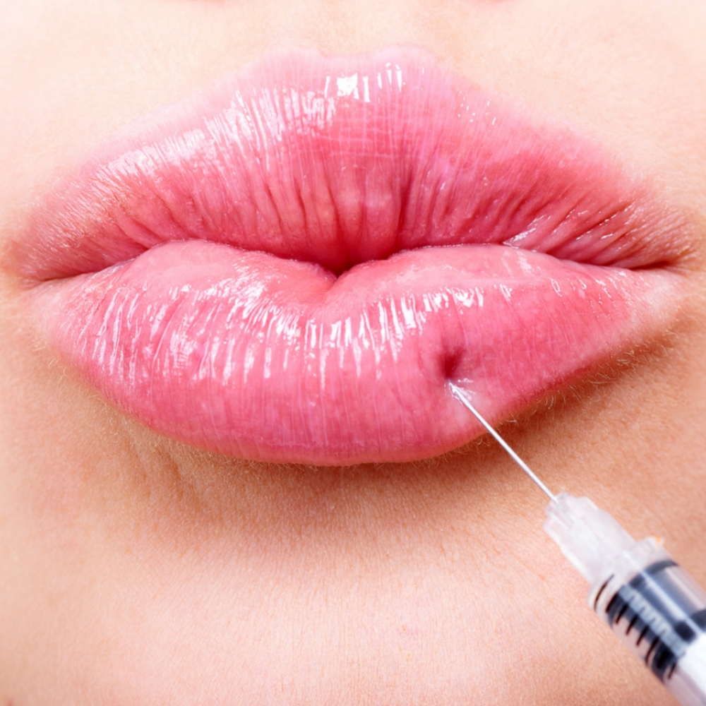 Petite Lip + 30 Units Tox at Skin by Jessica in Somerset, KY
