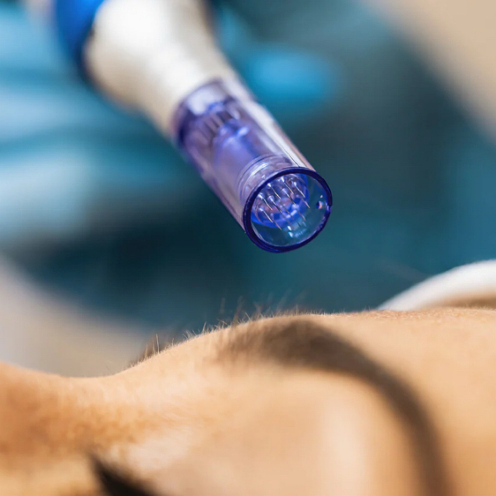 Microneedling at Bare Skin Beauty in Colorado Springs, CO