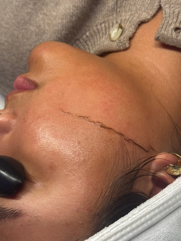 Dermaplaning Add On